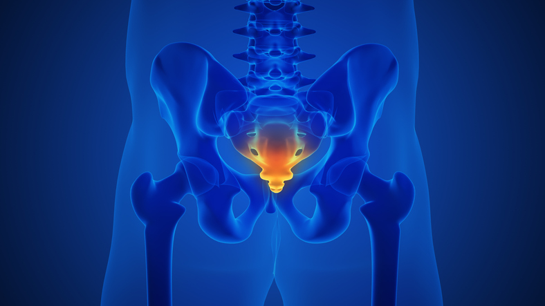 Coccydynia