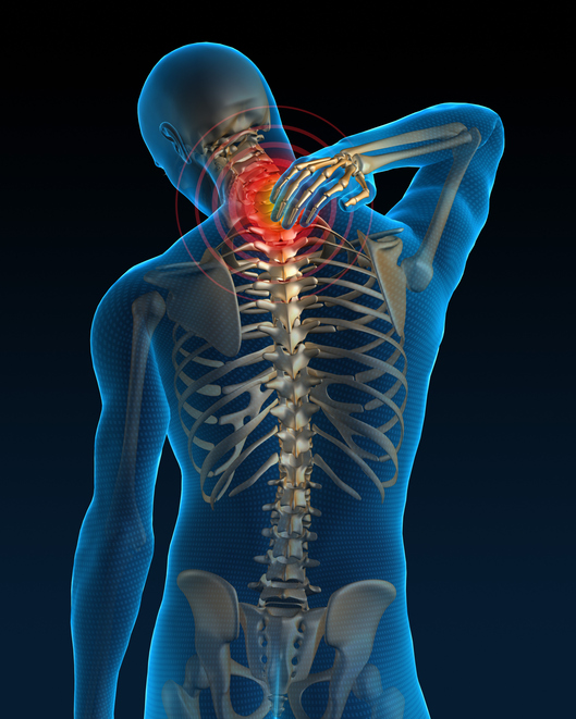 Muscle Strain